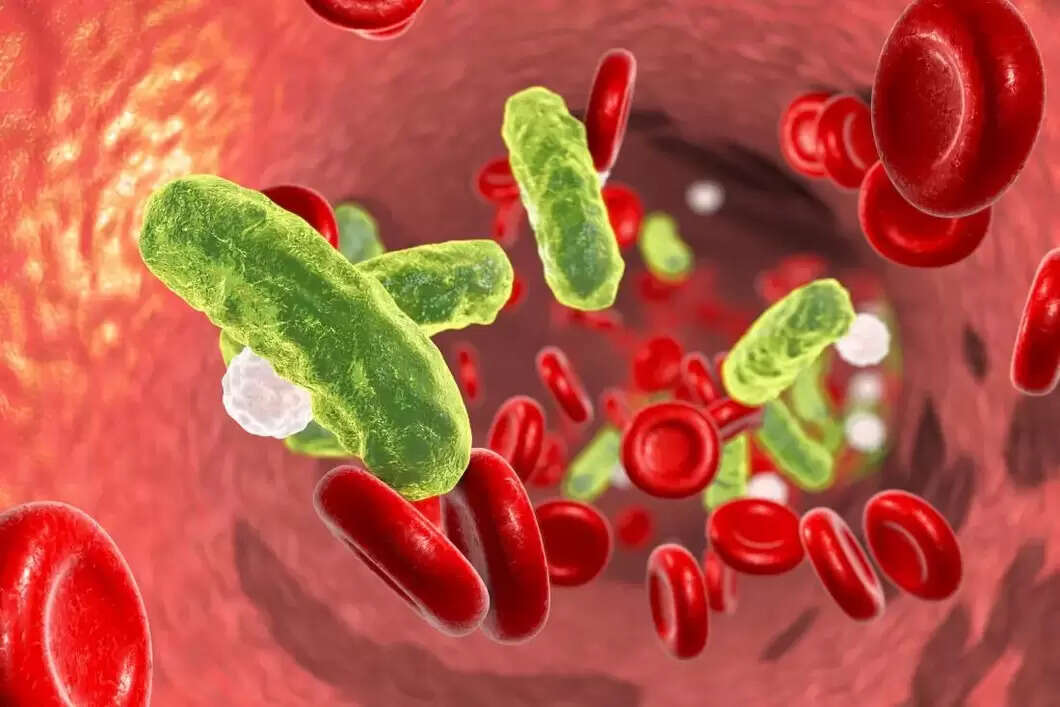 What Is Septicemia Causes Symptoms And Treatment