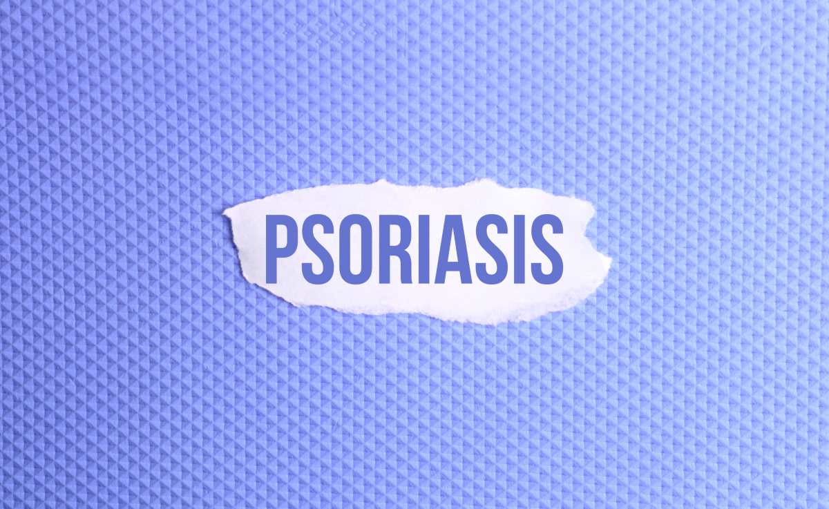 Psoriasis