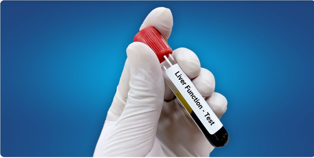 alanine-aminotransferase-in-a-blood-test