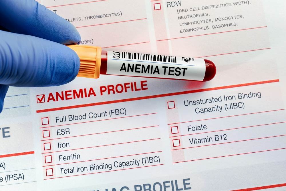 anemia-test