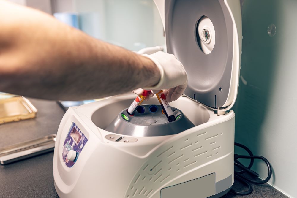 blood-samples-into-centrifuge