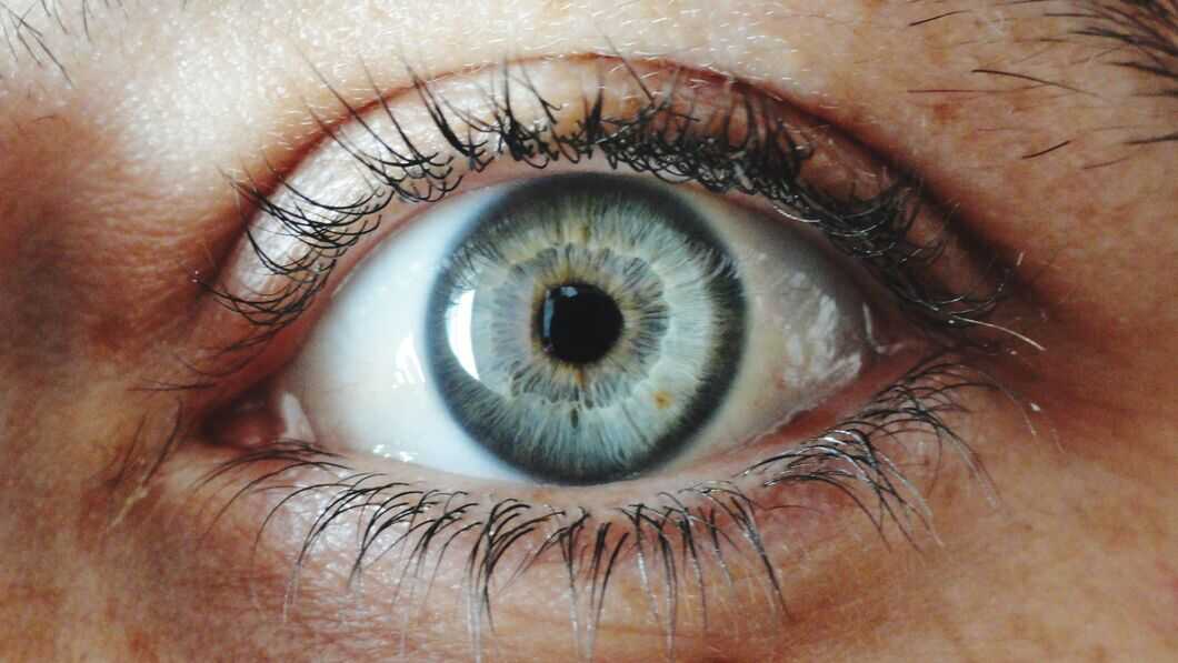 Eye Floaters Causes Symptoms Risks and Treatment