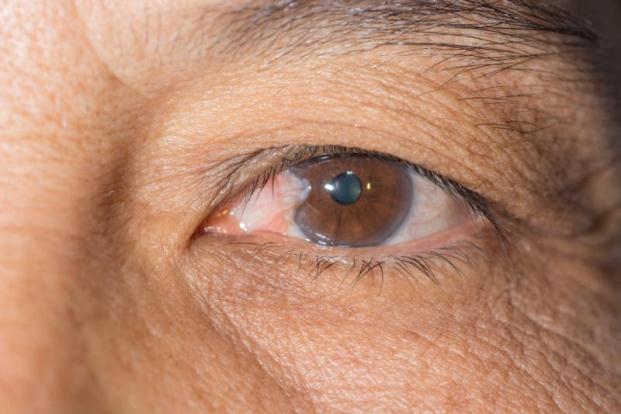 Common Eye Diseases List Of Most Common Eye Diseases In India