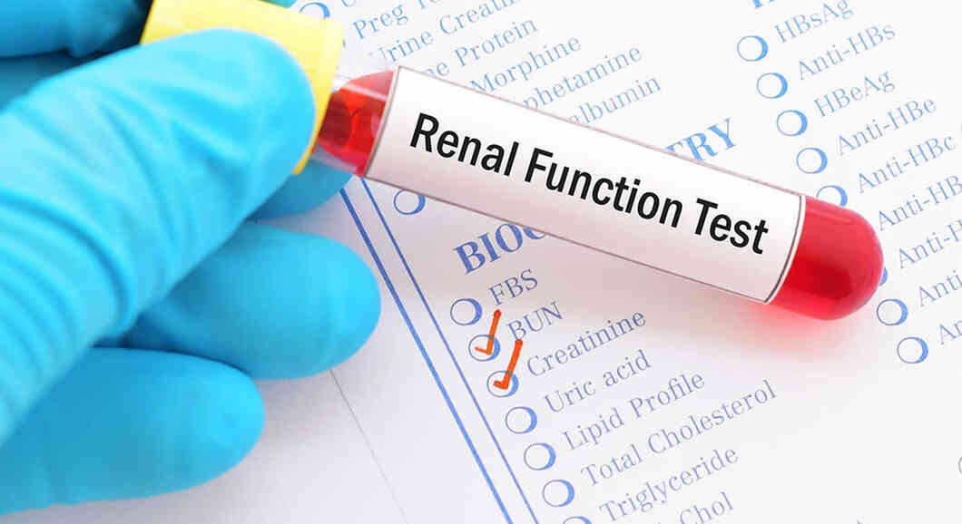 kidney-function-tests-purpose-types-and-procedure