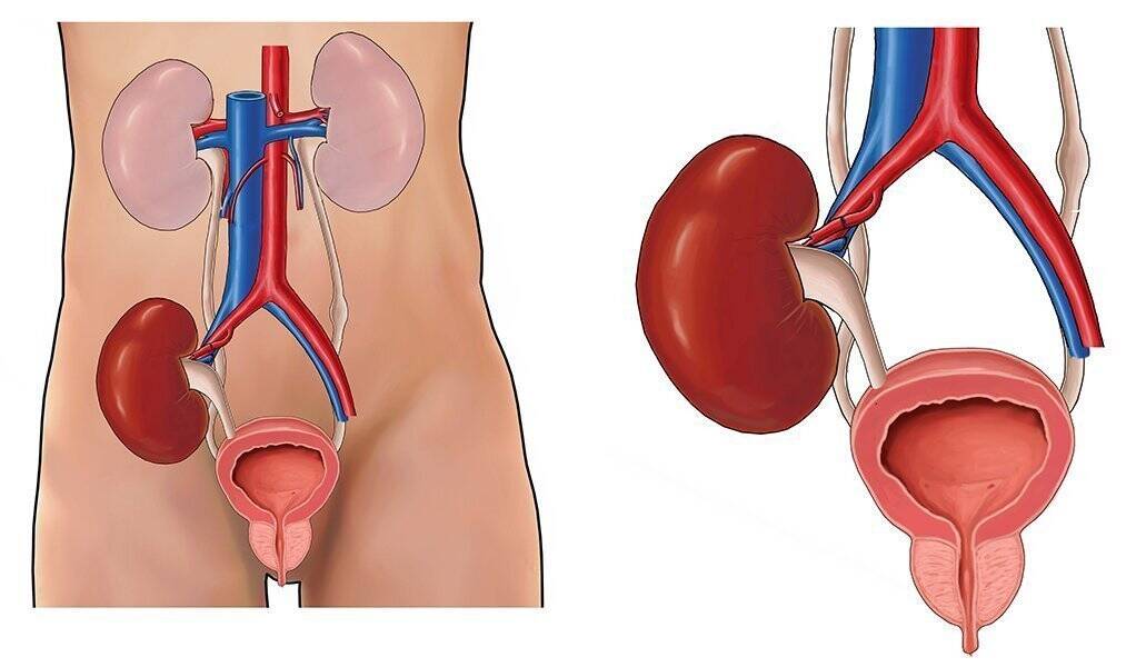 risk factors of kidney failure