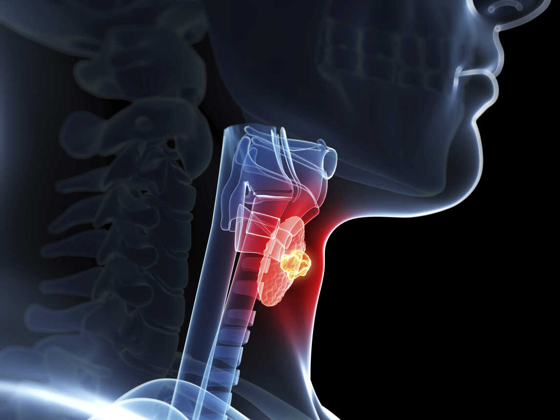 thyrotoxicosis-definition-symptoms-treatment-other