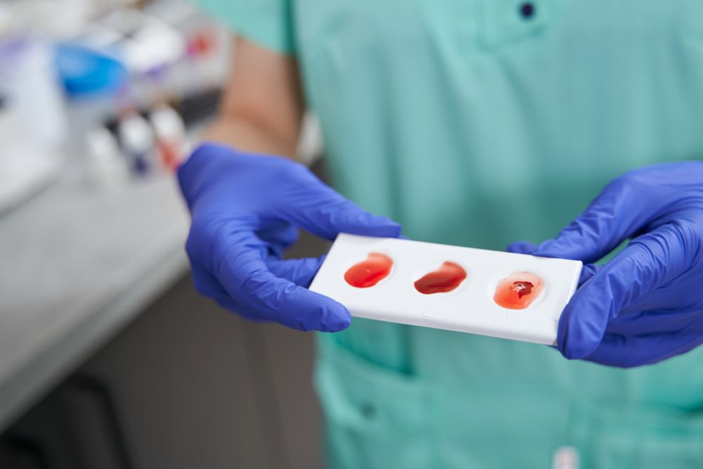 doctor-doing-medical-test-in-medical-lab