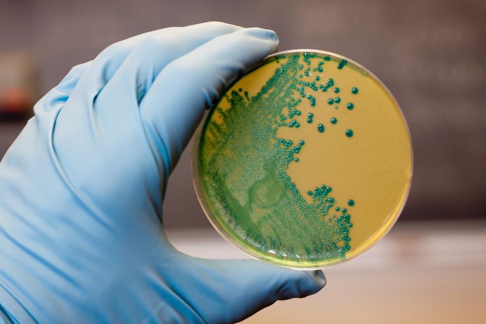 listeria-monocytogenes-growing