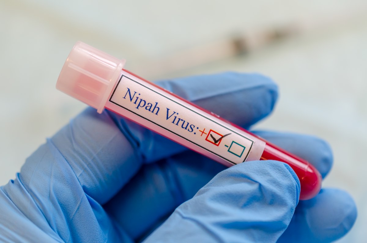 nipah virus