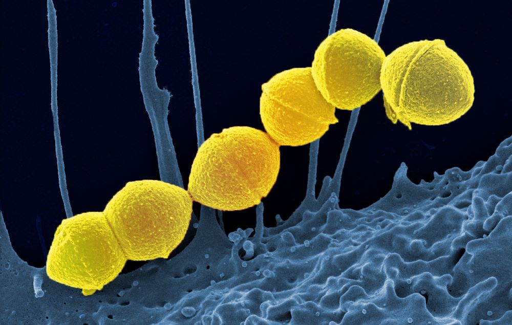 staphylococcus-aureus